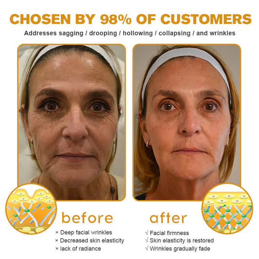 👨⚕️ Made and Shipped from US✅ Botox Bee Venom Wrinkle Removal Cream- LAST DAY 80% OFF