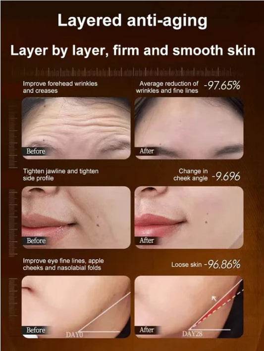🏆Flash Sale⚡🔥Micro-molecular collagen anti-wrinkle lotion