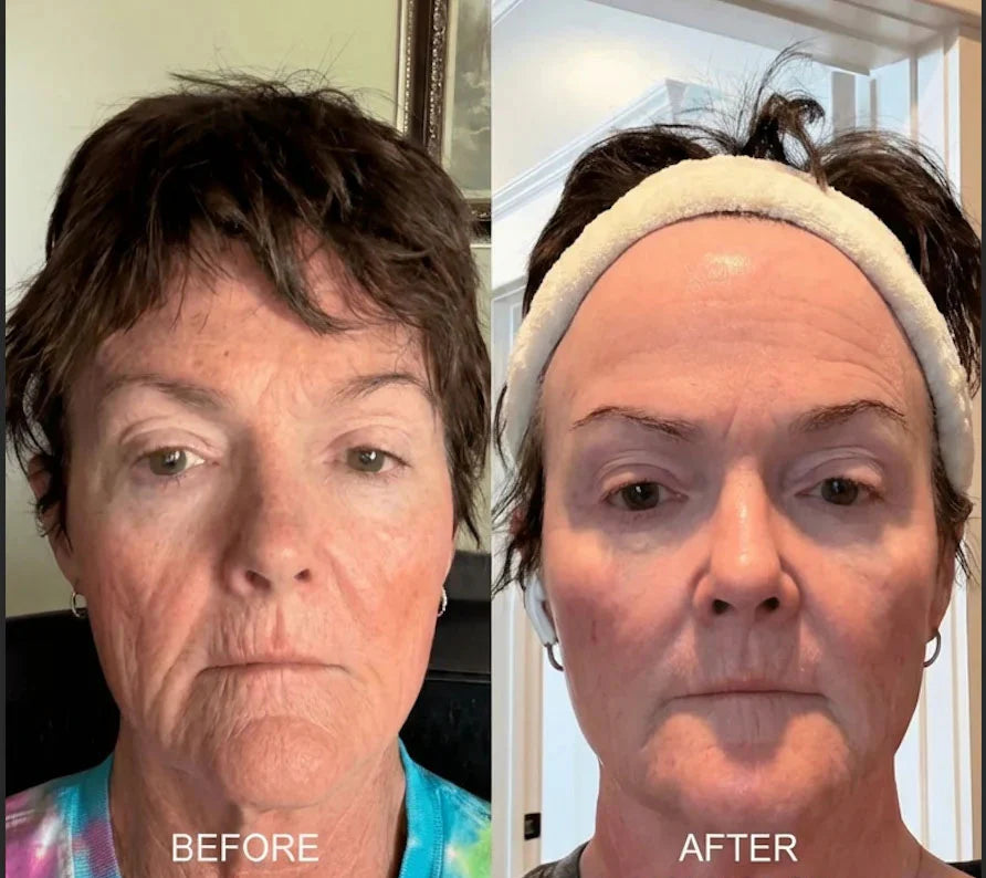✨ LAST DAY BUY 1 GET 1 FREE✨Deep Collagen Cream In Serum