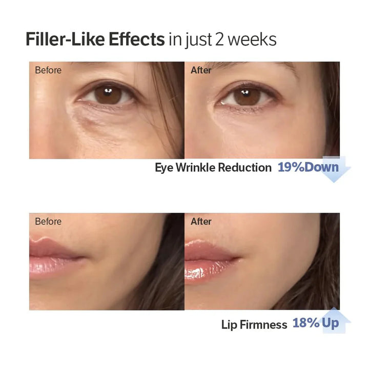 ✨ LAST DAY BUY 1 GET 1 FREE✨Deep Collagen Cream In Serum