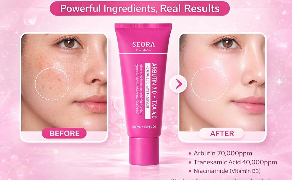 🔥Limited Time Offer🔥Tranexamic Acid Cream for Face &amp; Body