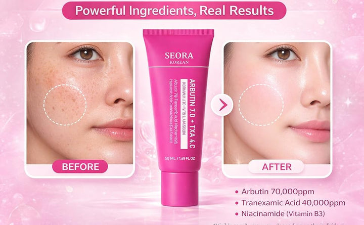🔥Limited Time Offer🔥Tranexamic Acid Cream for Face &amp; Body