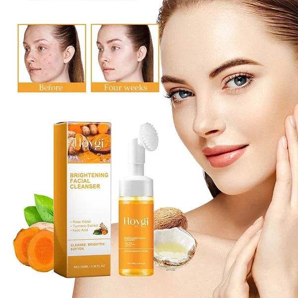 TURMERIC FACIAL CLEANSER FOR ACNE SCARS &amp; MARKS - DEEP CLEANSING &amp; BRIGHTENING