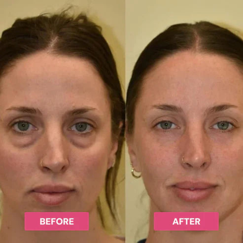 🔥Limited Time Offer🔥REVIVE TIRED EYES -HYDRATING &amp; ANTI-WRINKLE EYE BALM