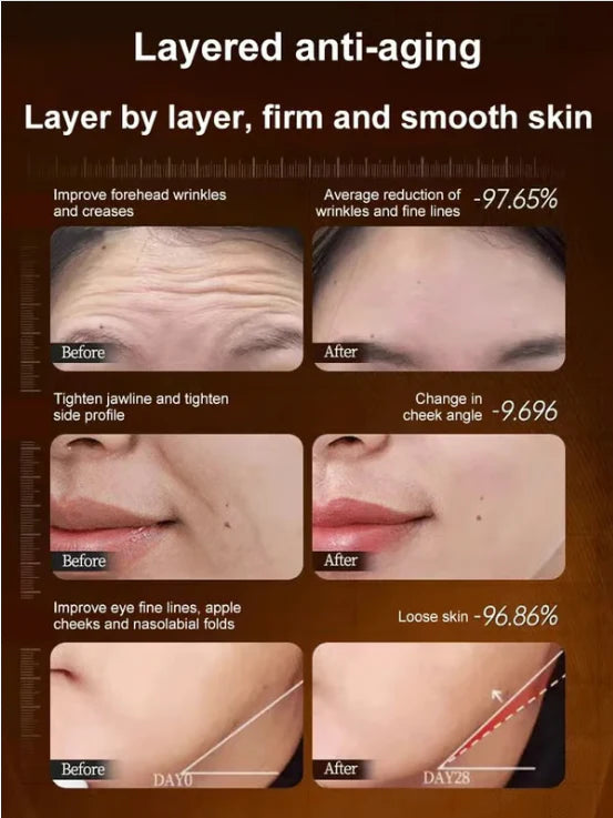 🏆Flash Sale⚡🔥Micro-molecular collagen anti-wrinkle lotion