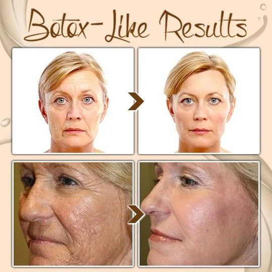 🏆Pamper Yourself🎁Polypeptide Firming Full Face Cream-CHANGE FOR BEAUTIFUL SKIN WITHIN 2 WEEKS