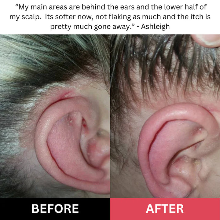 🏆Flash Sale⚡Revive + Restore Scalp Scrub