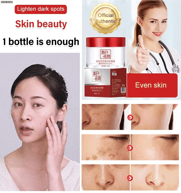 BRIGHTENING FRECKLE CREAM-BUY 2 GET 1 FREE💥