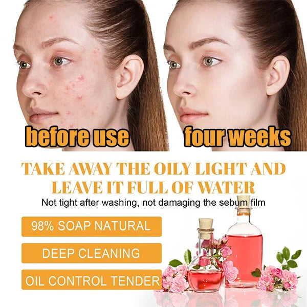 TURMERIC FACIAL CLEANSER FOR ACNE SCARS &amp; MARKS - DEEP CLEANSING &amp; BRIGHTENING