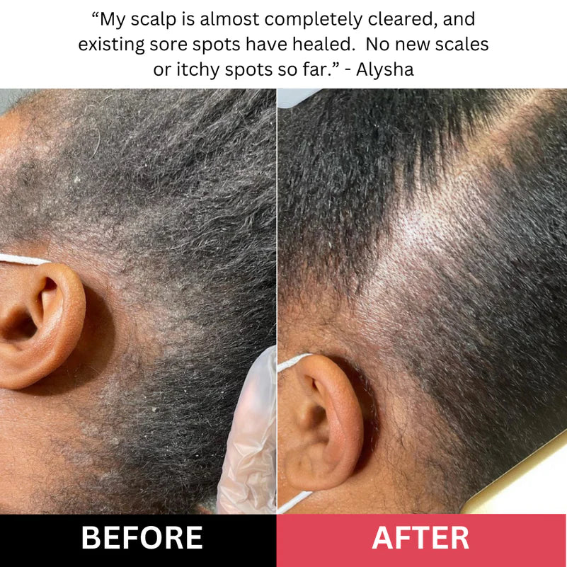 🏆Flash Sale⚡Revive + Restore Scalp Scrub
