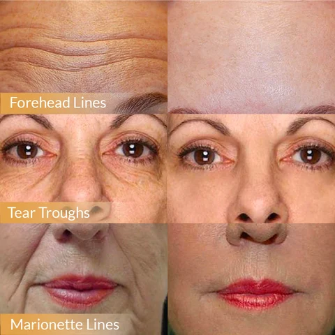 🏆Pamper Yourself🎁Polypeptide Firming Full Face Cream-CHANGE FOR BEAUTIFUL SKIN WITHIN 2 WEEKS