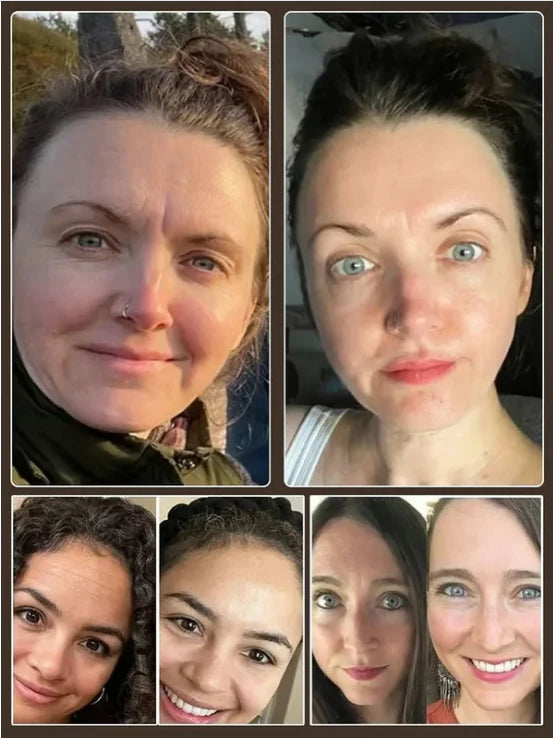 🏆Flash Sale⚡🔥Micro-molecular collagen anti-wrinkle lotion