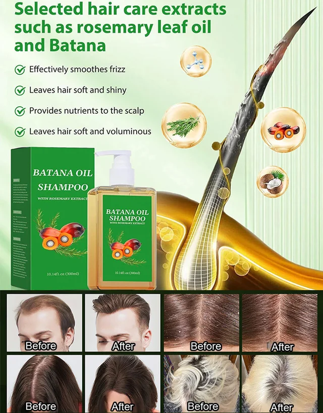 Hair growth shampoo