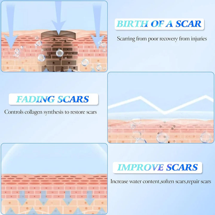 🔥Limited Time Offer🔥Skin Smoothing Scar Cream, Lighten &amp; Repair All Scars