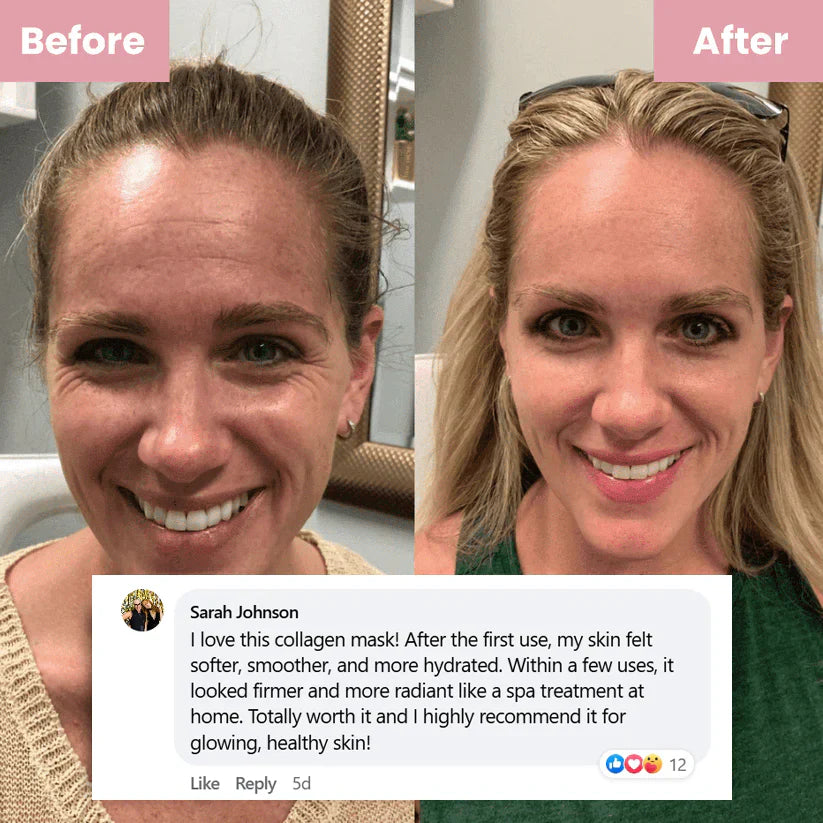 🏆Pamper Yourself —Collagen Night Wrapping Mask