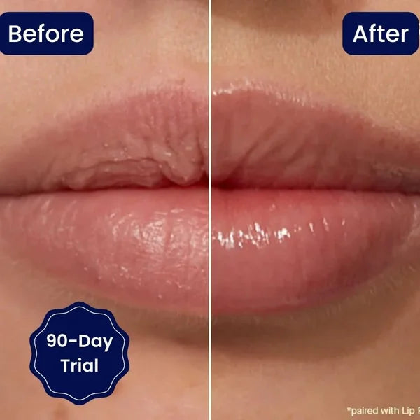 🎁2024 NEW YEAR HOT SALE🎁😍BIG SALE 🔥VITAMIN E LIP SERUM