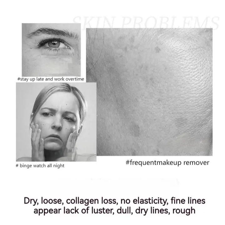 🏆Pamper Yourself🎁Polypeptide Firming Full Face Cream-CHANGE FOR BEAUTIFUL SKIN WITHIN 2 WEEKS