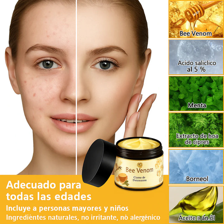 🐝PUROSA® Bee Venom Skin Treatment Cream, Anti-aging, Hydrating, Skin Repair, Even Tone, Acne and Dark Spot Treatment, Wart and Mole Removal, Psoriasis Relief