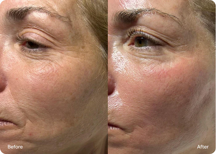 Dermatologists Are Calling This the Future of Foundation💞 🇰🇷 The 