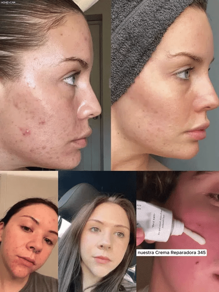 🏆Flash Sale⚡Hydrating and Nourishing Face Cream 345