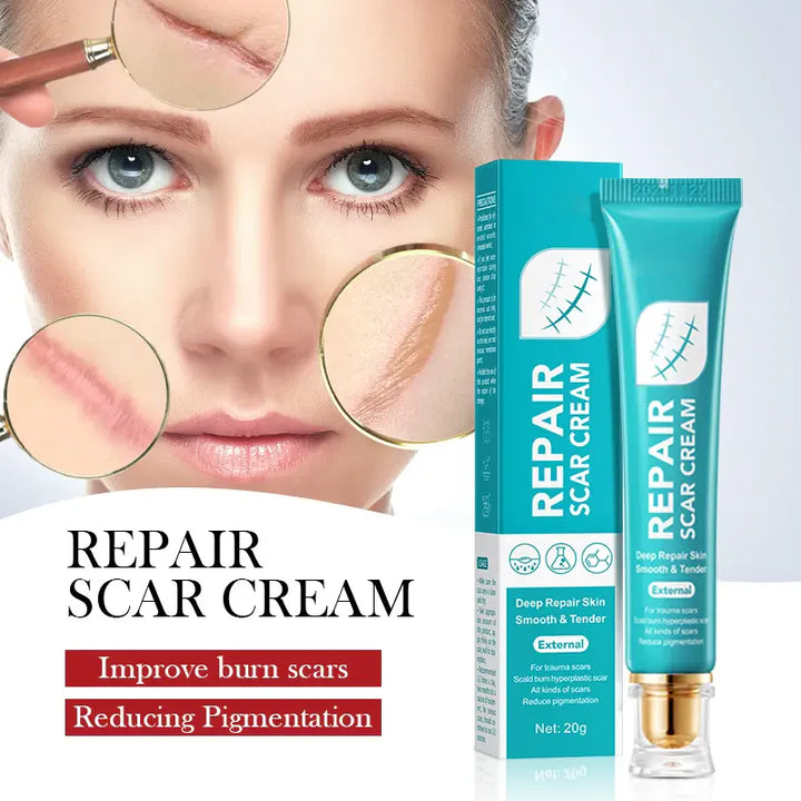🔥Limited Time Offer🔥Skin Smoothing Scar Cream, Lighten &amp; Repair All Scars