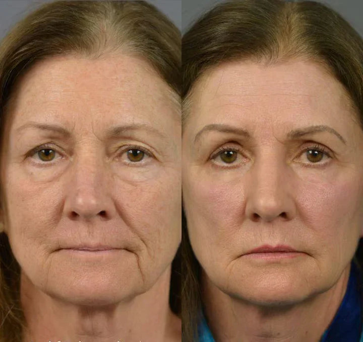 🔥Luxevéria Youth Rejuvenating Essence | Softens, smooths, and brightens mature skin