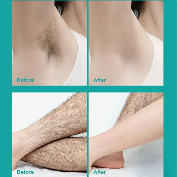 Full-Body Hair Removal Cream